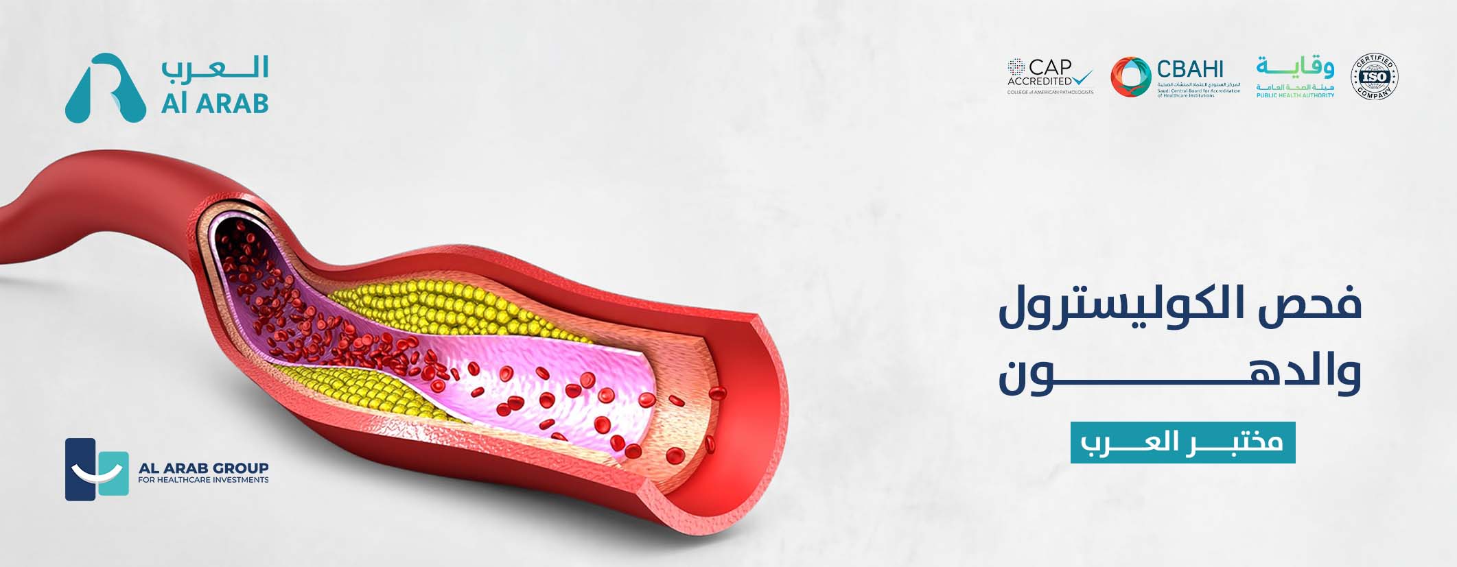 Cholesterol Tests in Riyadh  Al Arab Labs